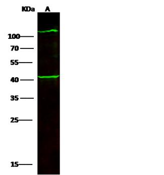COL6A3 / Collagen VI Alpha 3 Antibody - Anti-COL6A3 rabbit polyclonal antibody at 1:500 dilution. Lane A: NIH-3T3 Whole Cell Lysate. Lysates/proteins at 30 ug per lane. Secondary: Goat Anti-Rabbit IgG H&L (Dylight800) at 1/10000 dilution. Developed using the Odyssey technique. Performed under reducing conditions. Predicted band size: 108 kDa. Observed band size: 108 kDa. (We are unsure as to the identity of these extra bands.)