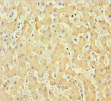 COL6A6 Antibody - Immunohistochemistry of paraffin-embedded human liver tissue using COL6A6 Antibody at dilution of 1:100