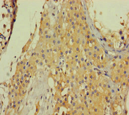 COL6A6 Antibody - Immunohistochemistry of paraffin-embedded human testis tissue using COL6A6 Antibody at dilution of 1:100