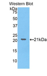 COL8A1 / Collagen VIII Alpha 1 Antibody - Western blot of recombinant COL8A1 / Collagen VIII.  This image was taken for the unconjugated form of this product. Other forms have not been tested.