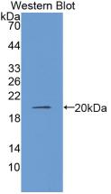 COL8A1 / Collagen VIII Alpha 1 Antibody - Western Blot; Sample: Recombinant protein.