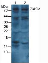 COL8A1 / Collagen VIII Alpha 1 Antibody - Western Blot; Sample. Lane1: Human Lung Tissue; Lane2: Human Hepg2 Cells.
