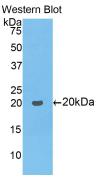 COL8A1 / Collagen VIII Alpha 1 Antibody - Western Blot; Sample: Recombinant protein.