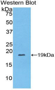 COL8A1 / Collagen VIII Alpha 1 Antibody - Western blot of recombinant COL8A1 / Collagen VIII.  This image was taken for the unconjugated form of this product. Other forms have not been tested.