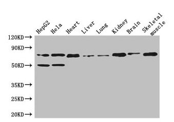 COL8A1 / Collagen VIII Alpha 1 Antibody - Western Blot Positive WB detected in: HepG2 whole cell lysate, Hela whole cell lysate, Mouse heart tissue, Mouse liver tissue, Mouse lung tissue, Mouse kidney tissue, Mouse brain tissue, Mouse skeletal muscle tissue All lanes: COL8A1 antibody at 3µg/ml Secondary Goat polyclonal to rabbit IgG at 1/50000 dilution Predicted band size: 74 kDa Observed band size: 74, 50 kDa
