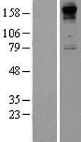 COL8A1 / Collagen VIII Alpha 1 Protein - Western validation with an anti-DDK antibody * L: Control HEK293 lysate R: Over-expression lysate