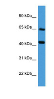 COL8A2 / Collagen VIII Antibody - COL8A2 antibody Western blot of Fetal Liver lysate.  This image was taken for the unconjugated form of this product. Other forms have not been tested.