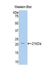 COL8A2 / Collagen VIII Antibody - Western blot of recombinant COL8A2 / Collagen VIII.  This image was taken for the unconjugated form of this product. Other forms have not been tested.