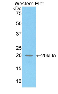 COL8A2 / Collagen VIII Antibody - Western blot of recombinant COL8A2 / Collagen VIII.  This image was taken for the unconjugated form of this product. Other forms have not been tested.