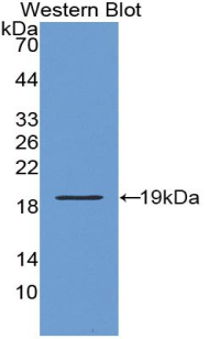 COL8A2 / Collagen VIII Antibody - Western Blot; Sample: Recombinant protein.