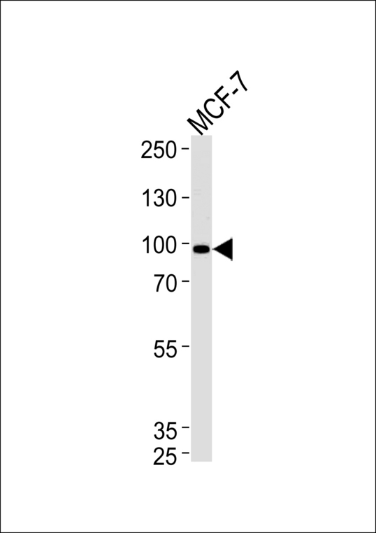 COL9A1 / Collagen IX Antibody - COL9A1 Antibody western blot of MCF-7 cell line lysates (35 ug/lane). The COL9A1 antibody detected the COL9A1 protein (arrow).