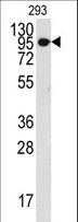 COL9A1 / Collagen IX Antibody - Western blot of anti-COL9A1 Antibody in 293 cell line lysates (35 ug/lane). COL9A1(arrow) was detected using the purified antibody.