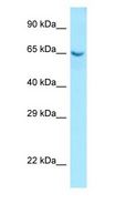 COL9A1 / Collagen IX Antibody - COL9A1 / Collagen IX antibody Western Blot of Fetal Small Intestine.  This image was taken for the unconjugated form of this product. Other forms have not been tested.