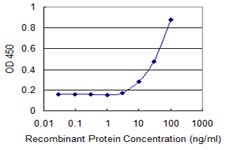 COL9A1 / Collagen IX Antibody - Detection limit for recombinant GST tagged COL9A1 is 3 ng/ml as a capture antibody.