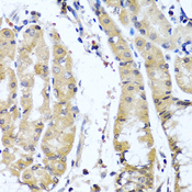 COL9A1 / Collagen IX Antibody - Immunohistochemistry of paraffin-embedded human stomach tissue.