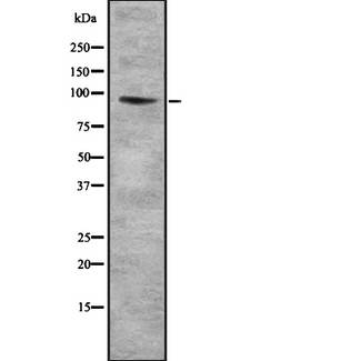 COL9A1 / Collagen IX Antibody - Western blot analysis of Collagen IX a1 using LOVO cells whole cells lysates