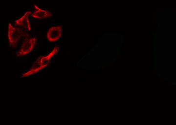 COL9A1 / Collagen IX Antibody - Staining HepG2 cells by IF/ICC. The samples were fixed with PFA and permeabilized in 0.1% Triton X-100, then blocked in 10% serum for 45 min at 25°C. The primary antibody was diluted at 1:200 and incubated with the sample for 1 hour at 37°C. An Alexa Fluor 594 conjugated goat anti-rabbit IgG (H+L) antibody, diluted at 1/600, was used as secondary antibody.