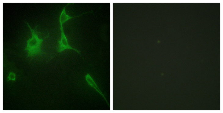 COL9A3 / Collagen IX Antibody - Immunofluorescence analysis of NIH/3T3 cells, using Collagen IX alpha3 Antibody. The picture on the right is blocked with the synthesized peptide.