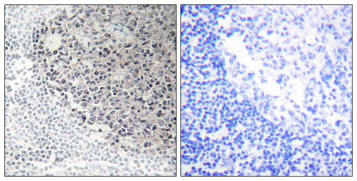 COL9A3 / Collagen IX Antibody - Immunohistochemistry analysis of paraffin-embedded human tonsil tissue, using Collagen IX alpha3 Antibody. The picture on the right is blocked with the synthesized peptide.
