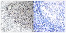 COL9A3 / Collagen IX Antibody - Immunohistochemistry analysis of paraffin-embedded human tonsil tissue, using Collagen IX alpha3 Antibody. The picture on the right is blocked with the synthesized peptide.