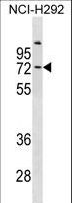 COL9A3 / Collagen IX Antibody - COL9A3 Antibody western blot of NCI-H292 cell line lysates (35 ug/lane). The COL9A3 antibody detected the COL9A3 protein (arrow).