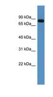 COL9A3 / Collagen IX Antibody - COL9A3 antibody Western blot of Fetal Heart lysate.  This image was taken for the unconjugated form of this product. Other forms have not been tested.