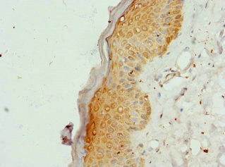 COL9A3 / Collagen IX Antibody - Immunohistochemistry of paraffin-embedded human skin tissue at dilution 1:100