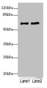 COL9A3 / Collagen IX Antibody - Western blot All Lanes: COL9A3antibody at 1.36ug/ml Lane 1 : MCF7 whole cell lysate Lane 2 : A549 whole cell lysate Secondary Goat polyclonal to Rabbit IgG at 1/10000 dilution Predicted band size: 64 kDa Observed band size: 64 kDa