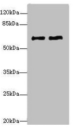 COL9A3 / Collagen IX Antibody - Western blot All lanes: COL9A3antibody at 1.36µg/ml Lane 1: MCF-7 whole cell lysate Lane 2: A549 whole cell lysate Secondary Goat polyclonal to rabbit IgG at 1/10000 dilution Predicted band size: 64 kDa Observed band size: 64 kDa