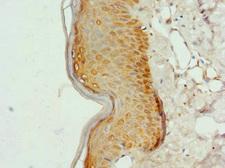 COL9A3 / Collagen IX Antibody - Immunohistochemistry of paraffin-embedded human skin tissue at dilution 1:100