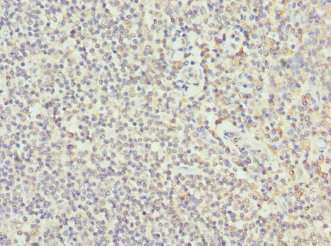 COL9A3 / Collagen IX Antibody - Immunohistochemistry of paraffin-embedded human tonsil tissue at dilution 1:100