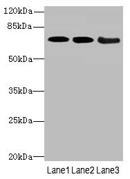 COL9A3 / Collagen IX Antibody - Western blot All Lanes: COL9A3antibody at 3.66ug/ml Lane 1 : K562 whole cell lysate Lane 2 : MCF7 whole cell lysate Lane 3 : A549 whole cell lysate Secondary Goat polyclonal to Rabbit IgG at 1/10000 dilution Predicted band size: 64 kDa Observed band size: 64 kDa