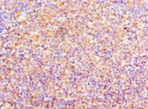 COLEC10 Antibody - Immunohistochemistry of paraffin-embedded human tonsil using antibody at 1:100 dilution.  This image was taken for the unconjugated form of this product. Other forms have not been tested.