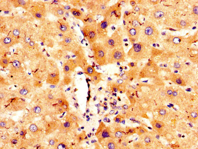 COLEC10 Antibody - IHC image of COLEC10 Antibody diluted at 1:300 and staining in paraffin-embedded human liver tissue performed on a Leica BondTM system. After dewaxing and hydration, antigen retrieval was mediated by high pressure in a citrate buffer (pH 6.0). Section was blocked with 10% normal goat serum 30min at RT. Then primary antibody (1% BSA) was incubated at 4°C overnight. The primary is detected by a biotinylated secondary antibody and visualized using an HRP conjugated SP system.