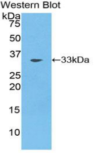 COLEC10 Antibody - Western blot of recombinant COLEC10.  This image was taken for the unconjugated form of this product. Other forms have not been tested.