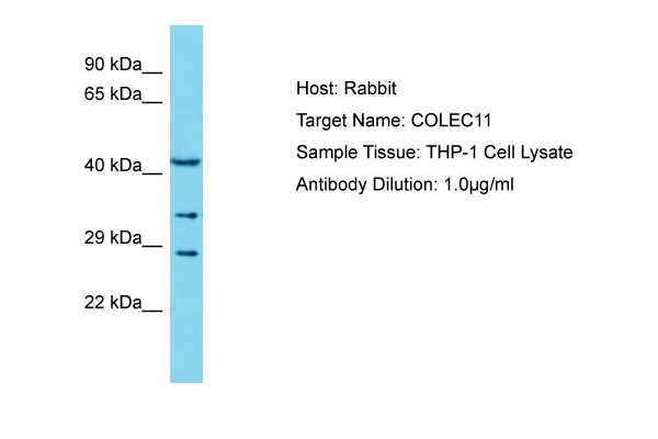 COLEC11 Antibody -  This image was taken for the unconjugated form of this product. Other forms have not been tested.
