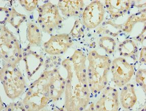 COLEC11 Antibody - Immunohistochemistry of paraffin-embedded human liver tissue using antibody at 1:100 dilution.