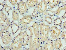 COLEC11 Antibody - Immunohistochemistry of paraffin-embedded human liver tissue using antibody at 1:100 dilution.