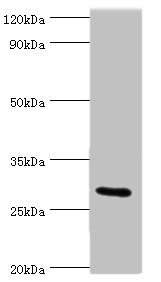 COLEC11 Antibody - Western blot All lanes: COLEC11 antibody at 4µg/ml + Rat liver tissue Secondary Goat polyclonal to rabbit IgG at 1/10000 dilution Predicted band size: 29, 27, 22, 30, 25, 24, 31 kDa Observed band size: 29 kDa