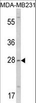 COLEC11 Antibody - Western blot of COLEC11 Antibody in MDA-MB231 cell line lysates (35 ug/lane). COLEC11 (arrow) was detected using the purified antibody.