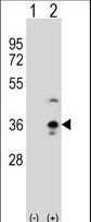 COLEC11 Antibody - Western blot of COLEC11 (arrow) using rabbit polyclonal COLEC11 Antibody. 293 cell lysates (2 ug/lane) either nontransfected (Lane 1) or transiently transfected (Lane 2) with the COLEC11 gene.