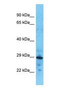 COLEC11 Antibody - Western blot of COLEC11 Antibody with human 721_B Whole Cell lysate.  This image was taken for the unconjugated form of this product. Other forms have not been tested.