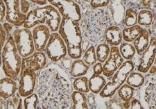 COLEC11 Antibody - 1:100 staining human kidney tissue by IHC-P. The sample was formaldehyde fixed and a heat mediated antigen retrieval step in citrate buffer was performed. The sample was then blocked and incubated with the antibody for 1.5 hours at 22°C. An HRP conjugated goat anti-rabbit antibody was used as the secondary.