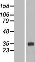 COLEC11 Protein - Western validation with an anti-DDK antibody * L: Control HEK293 lysate R: Over-expression lysate