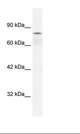 COLEC12 Antibody - Jurkat Cell Lysate.  This image was taken for the unconjugated form of this product. Other forms have not been tested.