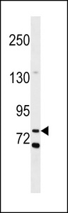 COLEC12 Antibody - COL12 Antibody western blot of MDA-MB453 cell line lysates (35 ug/lane). The COL12 antibody detected the COL12 protein (arrow).