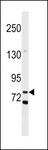 COLEC12 Antibody - COL12 Antibody western blot of MDA-MB453 cell line lysates (35 ug/lane). The COL12 antibody detected the COL12 protein (arrow).