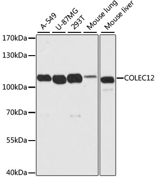 COLEC12 Antibody - Western blot analysis of extracts of various cell lines, using COLEC12 antibody at 1:2000 dilution. The secondary antibody used was an HRP Goat Anti-Rabbit IgG (H+L) at 1:10000 dilution. Lysates were loaded 25ug per lane and 3% nonfat dry milk in TBST was used for blocking. An ECL Kit was used for detection and the exposure time was 5s.