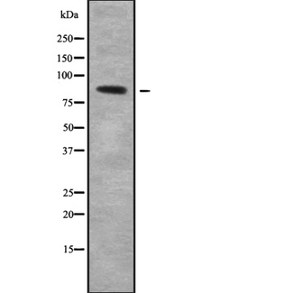 COLEC12 Antibody - Western blot analysis of COLEC12 using HT29 whole cells lysates