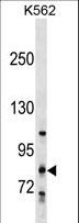 COLGALT2 / GLT25D2 Antibody - GLT25D2 Antibody western blot of K562 cell line lysates (35 ug/lane). The GLT25D2 antibody detected the GLT25D2 protein (arrow).